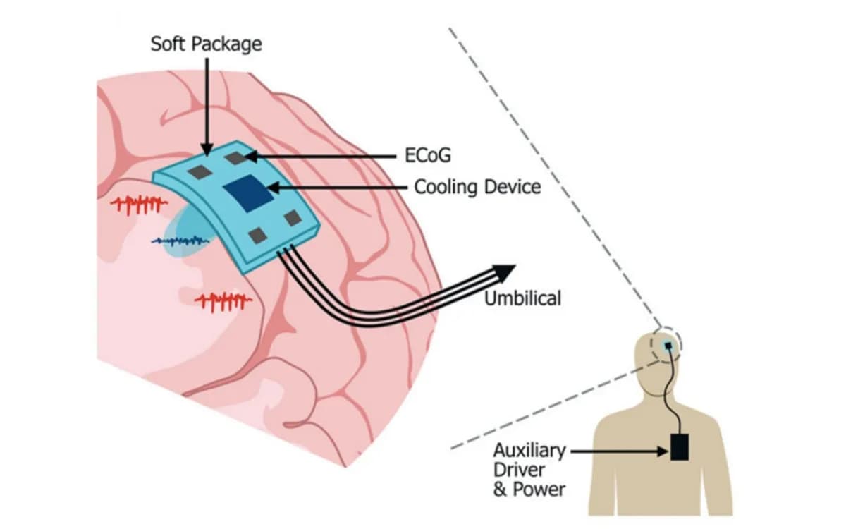 Desarrollo de un implante cerebral impreso en 3D que registra y enfría