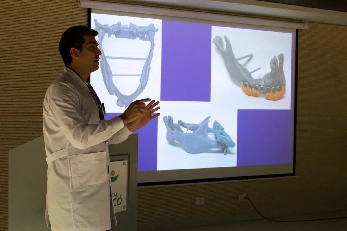 Hospital de Curicó implementa tecnología de impresión 3D para cirugías maxilofaciales