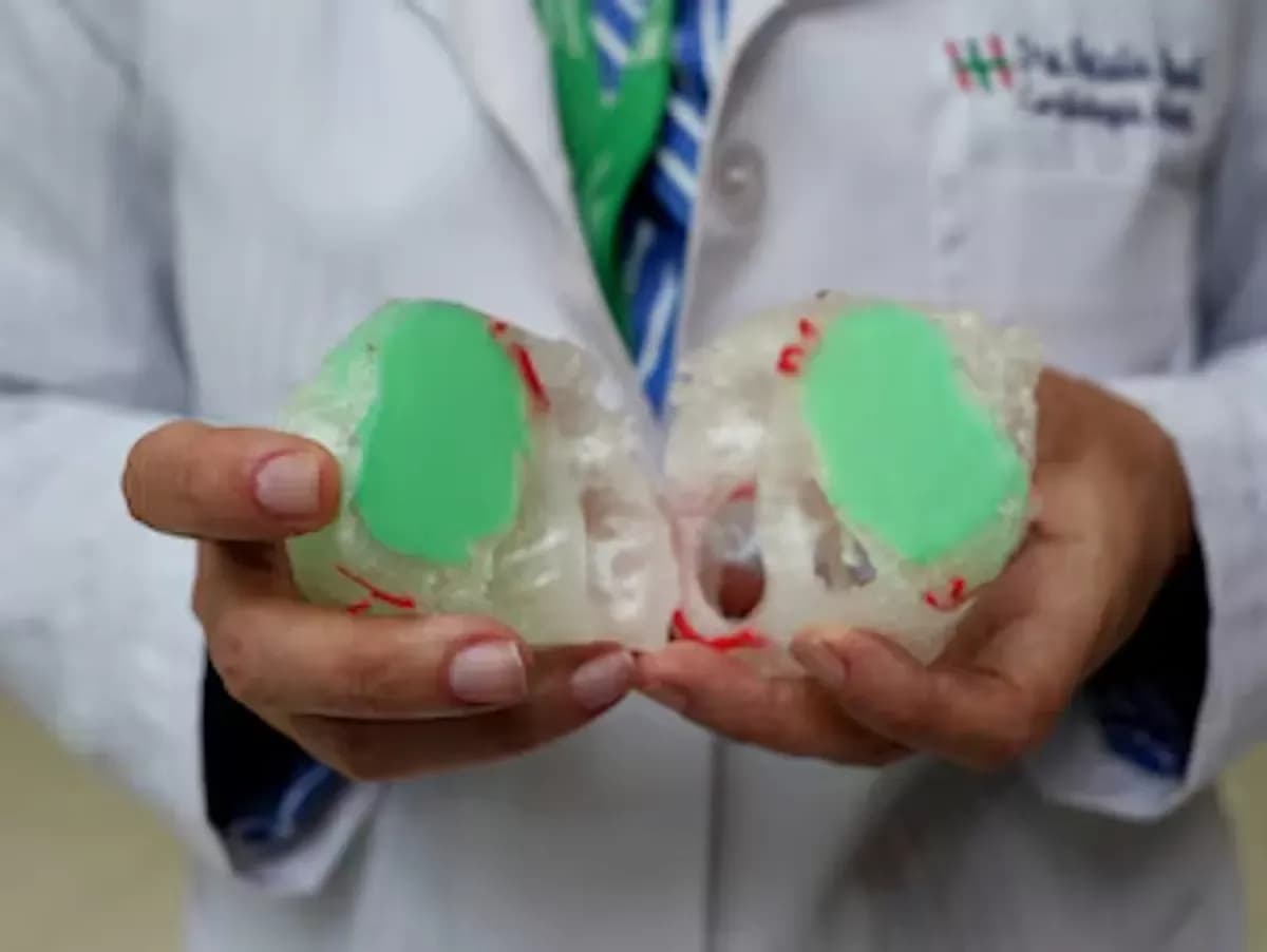 Un corazón impreso en 3D ayuda a un niño con tumor cardíaco