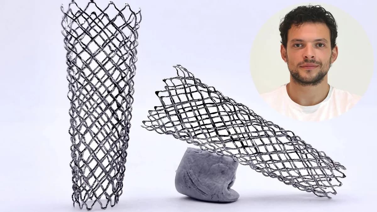 NitiBraid: implantes vasculares personalizados mediante impresión 3D en España