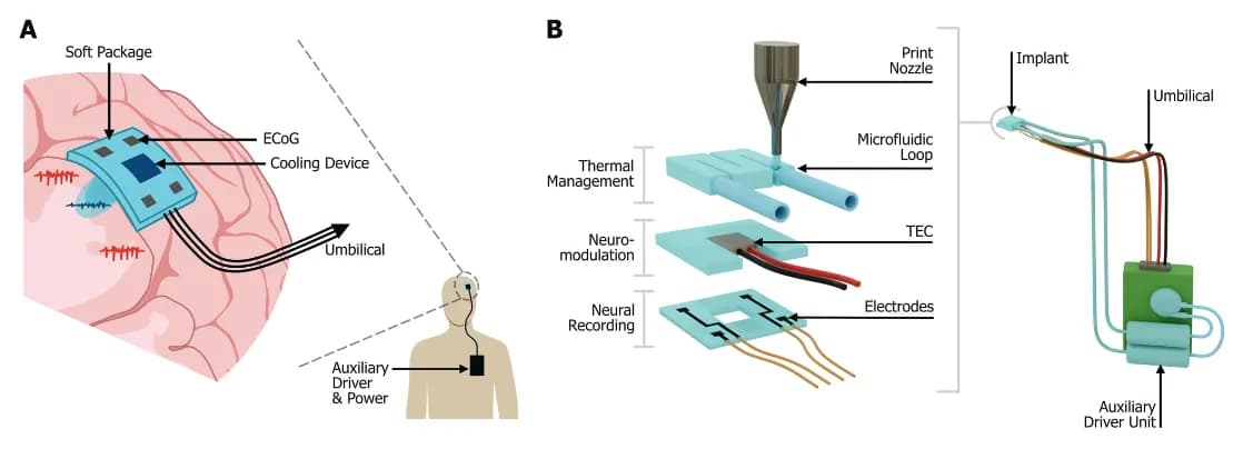 Implante cerebral impreso en 3D para tratar la epilepsia resistente a fármacos